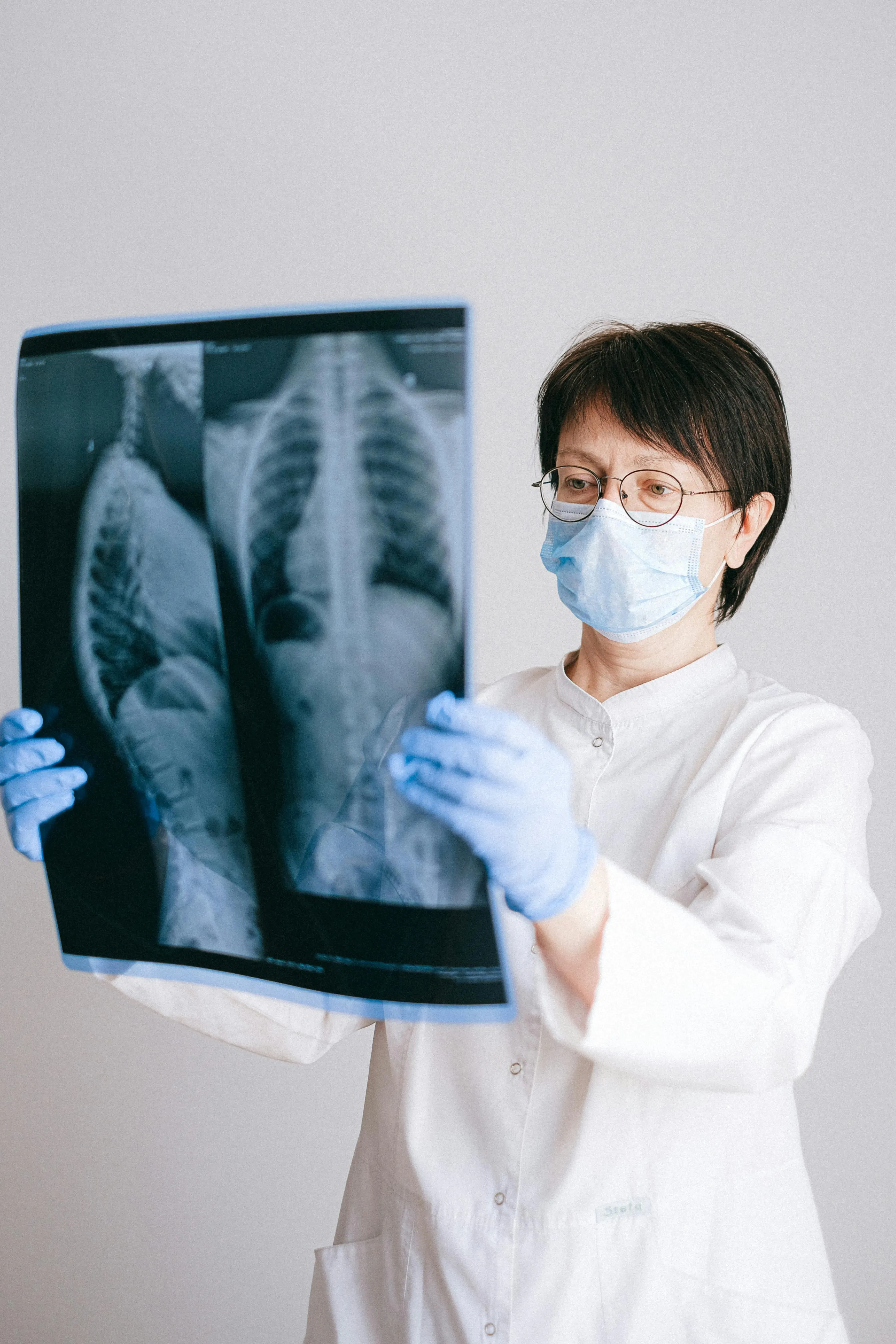 image docteur qui regarde l'IRM d'un patient